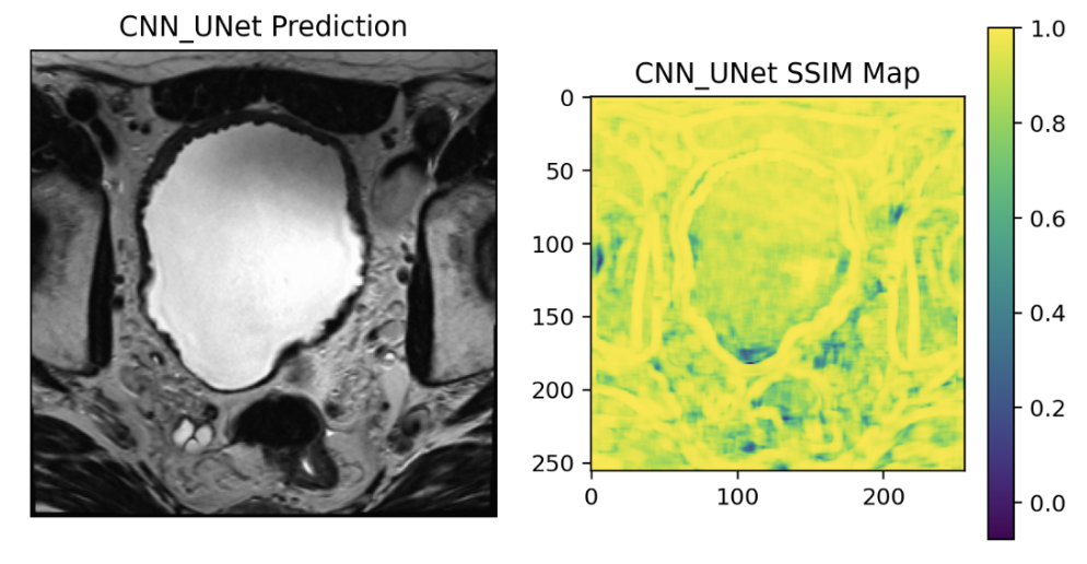 Prostate MRI Super-Resolution